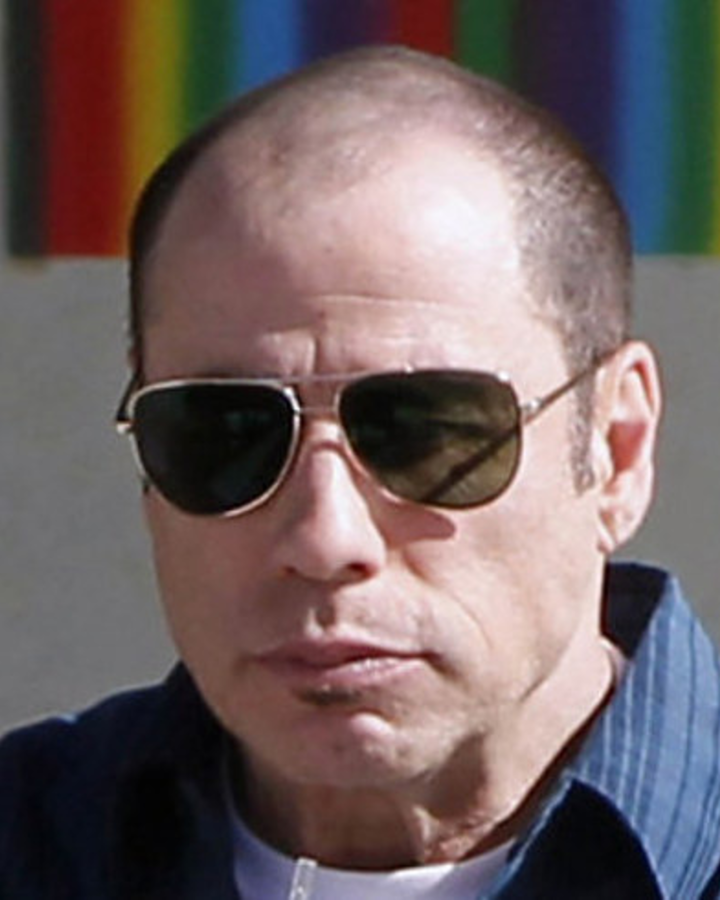 Voor behandeling: John Travolta