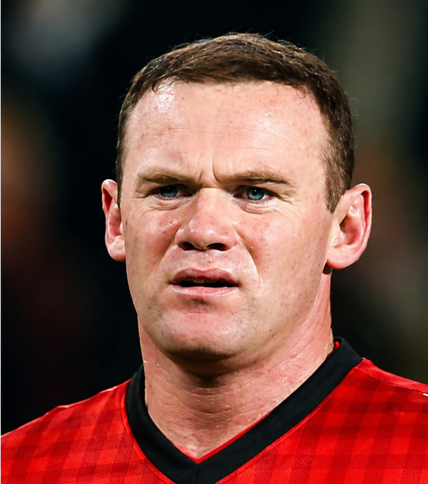 Na behandeling: Wayne Rooney