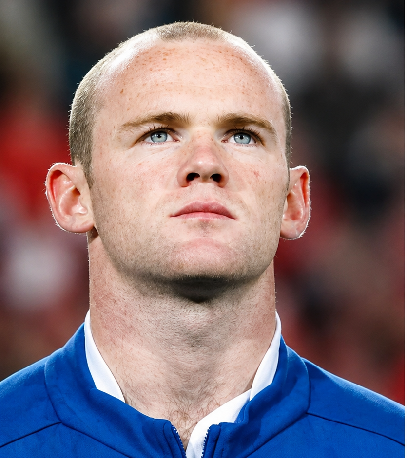 Voor behandeling: Wayne Rooney